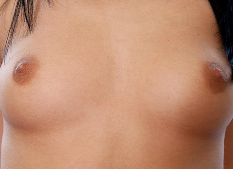 Natural Amateur Asdyna - 9 of 16